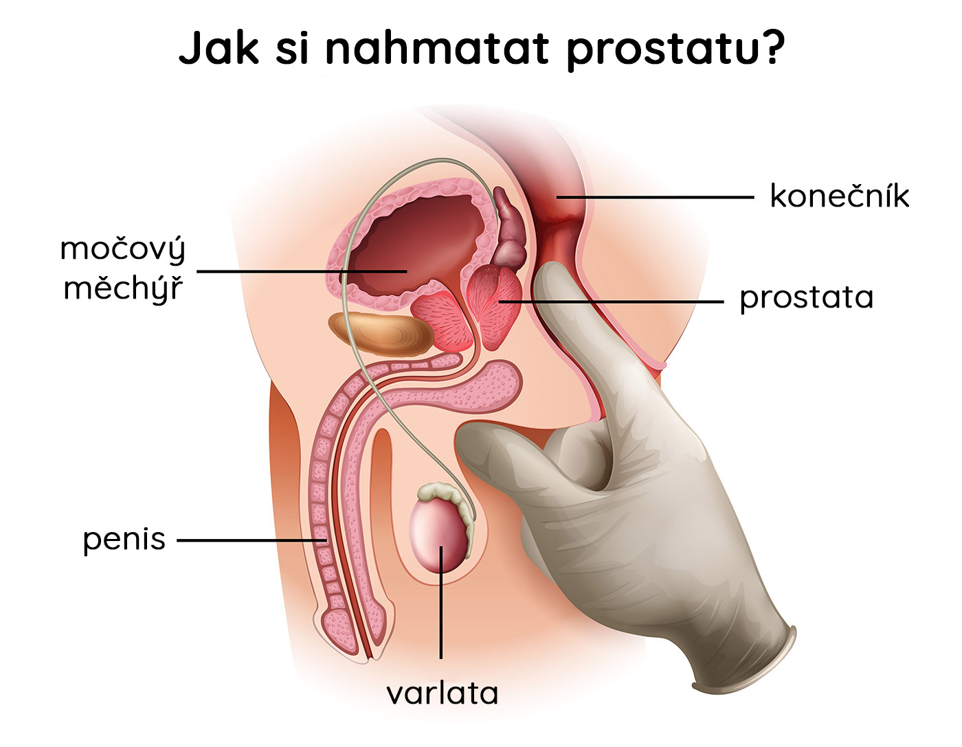 Jak si nahmatat prostatu?