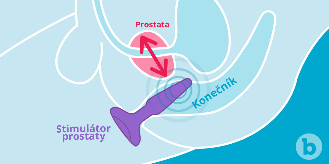 Stimulácia prostaty